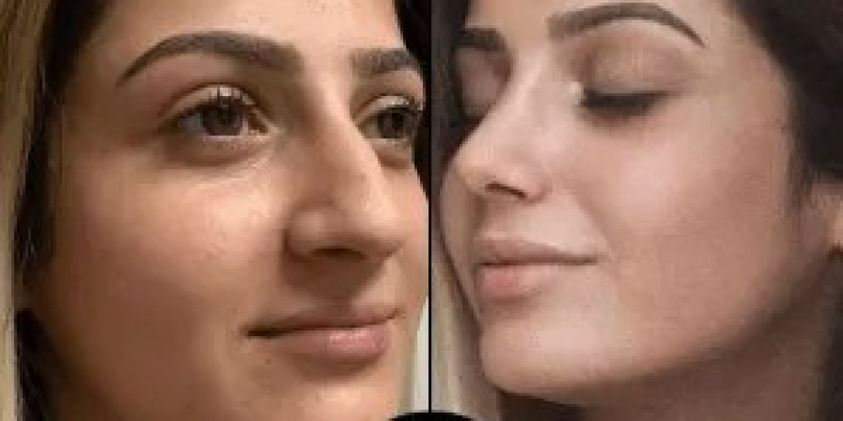 From Dull to Glowing: My Visit to the Best Aesthetic Clinic in Dubai