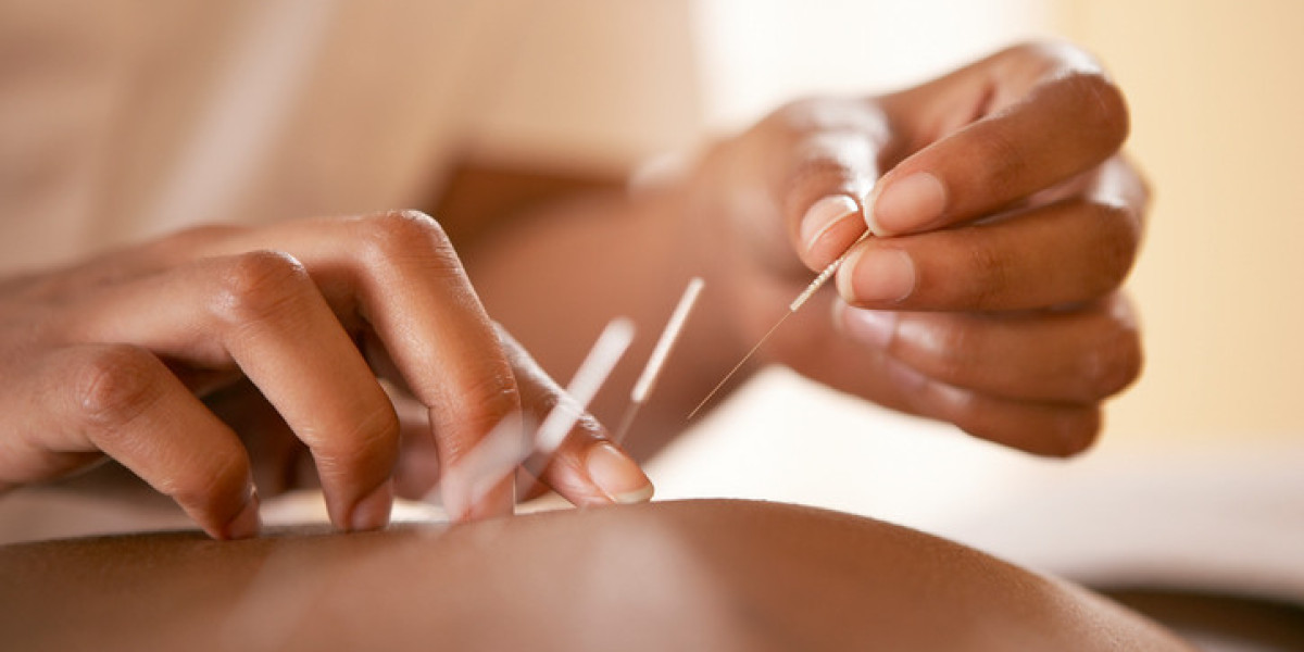 Acupuncture For IVF Support