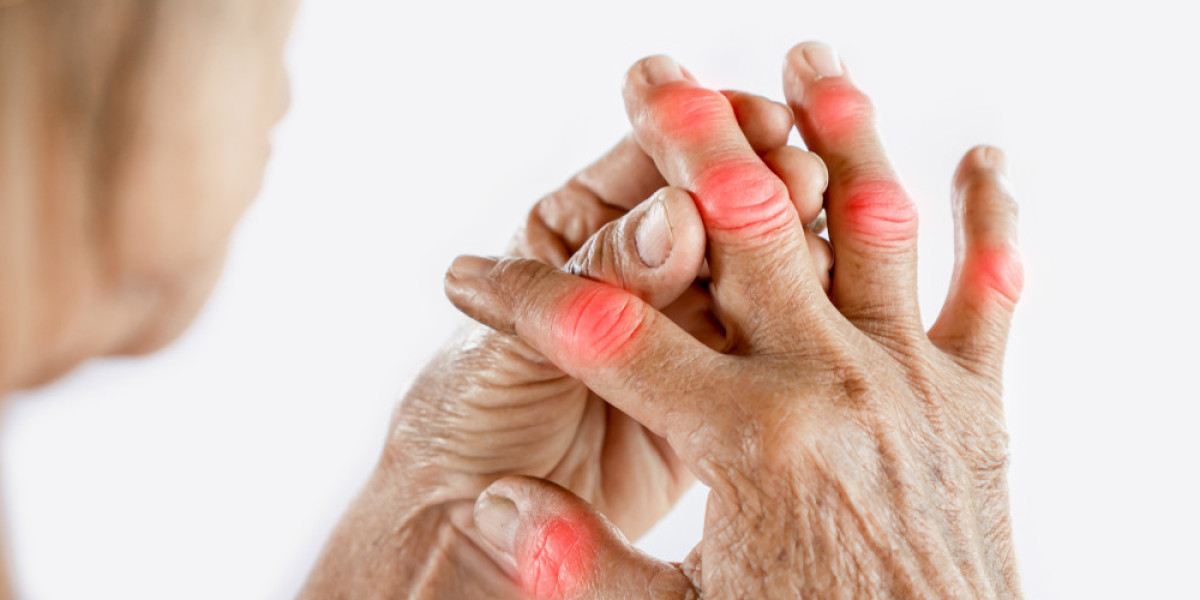 Peripheral Neuropathy: Understanding the Condition, Symptoms, and Treatment