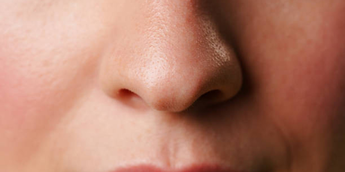 كيف تختار جراحًا متخصصًا وآمنًا لعملية تصغير فتحات الأنف في الرياض؟