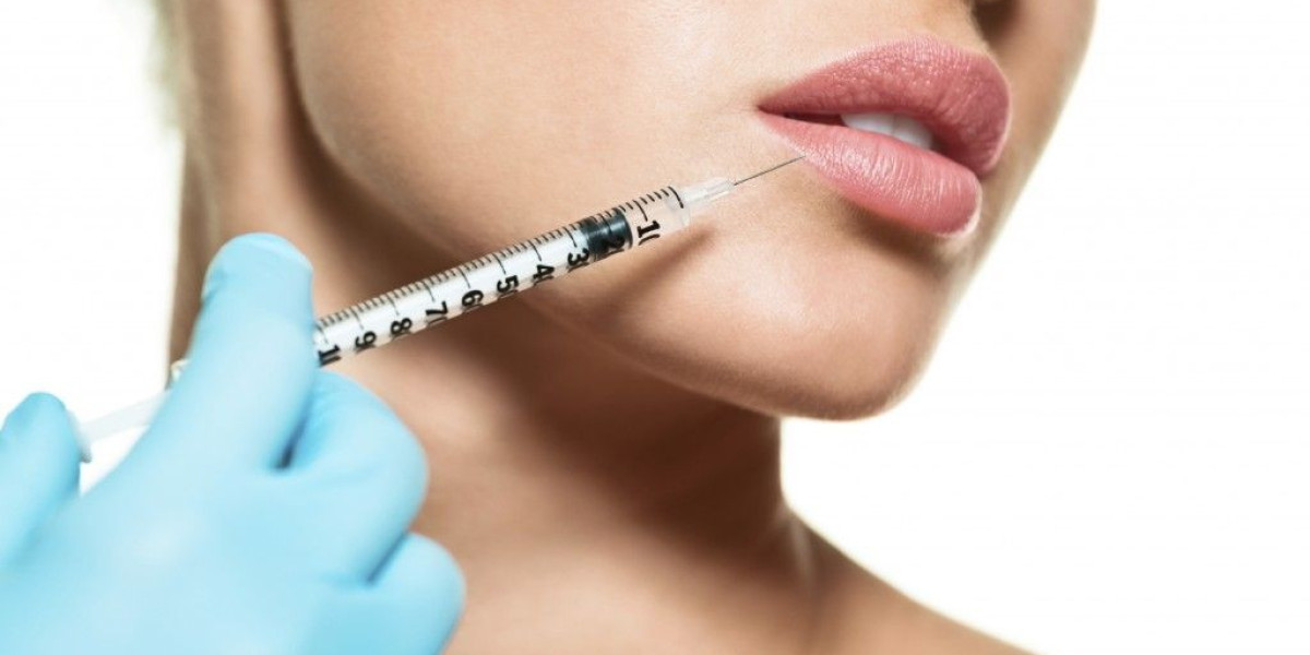 Common Questions About Best Lip Fillers Injections Answered Clearly