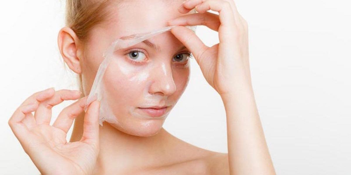 A Beginner’s Guide to Chemical Peels for Clearer Skin