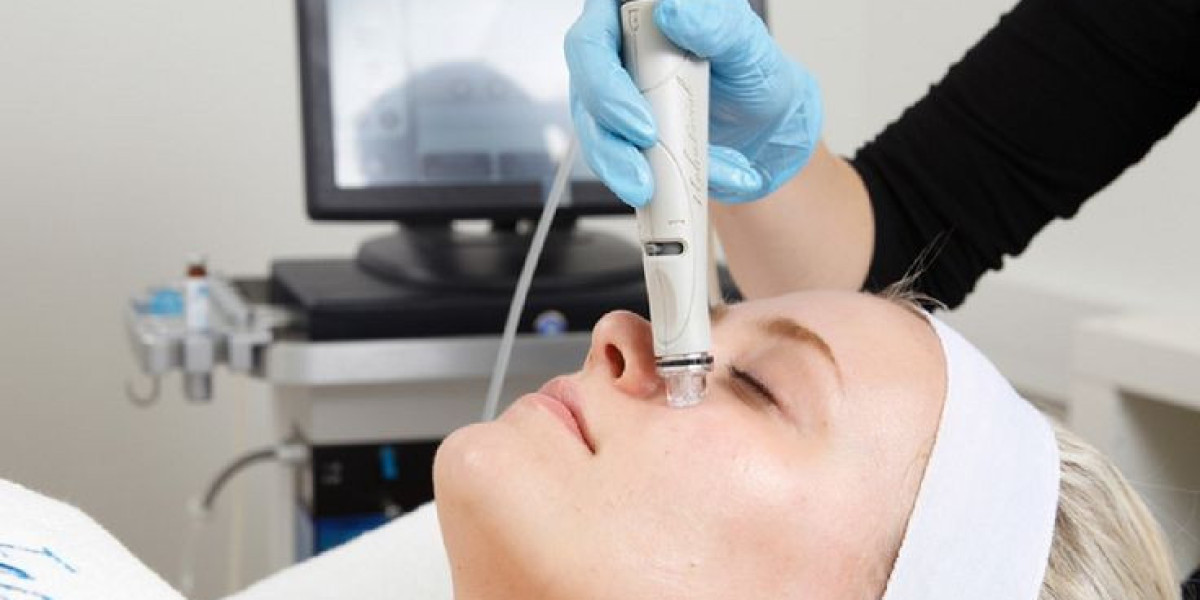 Why Hydrafacial Is the Best Solution for Gentle Skin Renewal