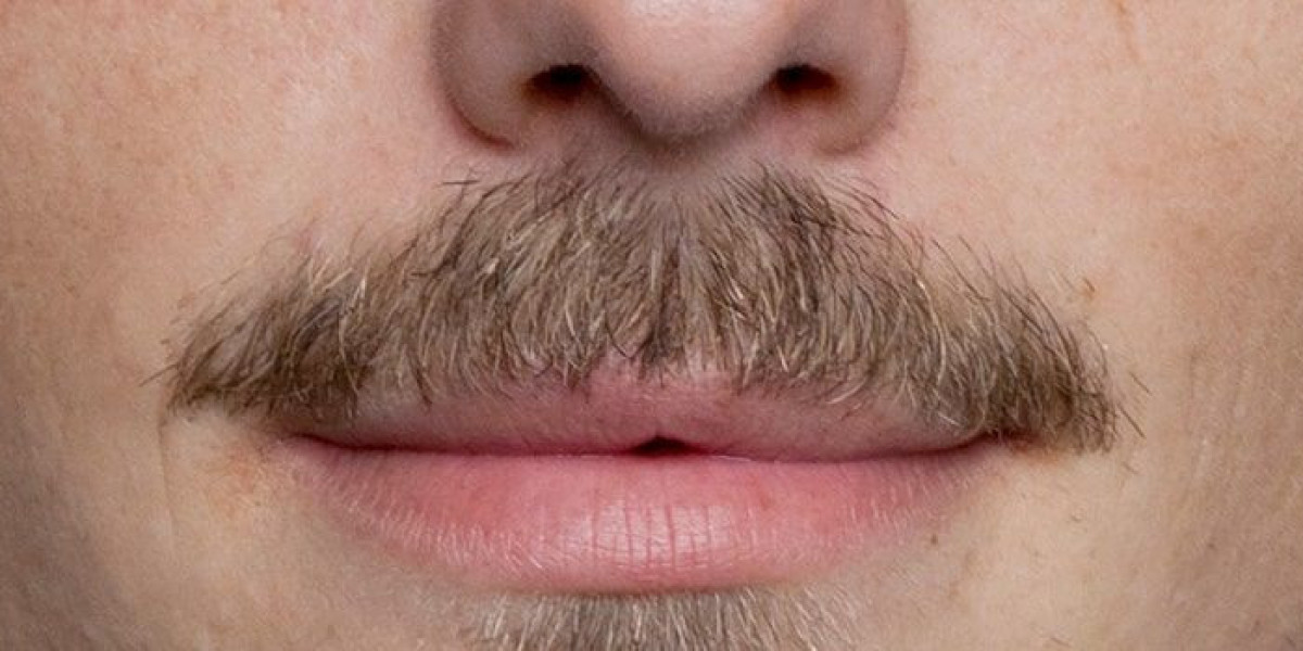 Advanced Mustache Hair Transplant for Natural Hair Growth | Royal Clinic