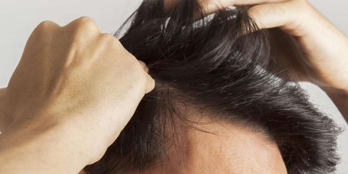 قرار زراعة الشعر يبدأ بفهم احتياجاتك الجمالية