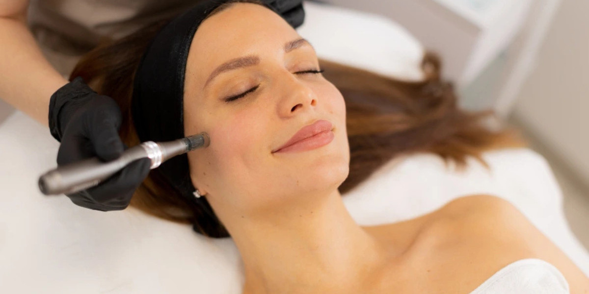 Comparing At-Home vs. Professional Microneedling Toronto Treatments
