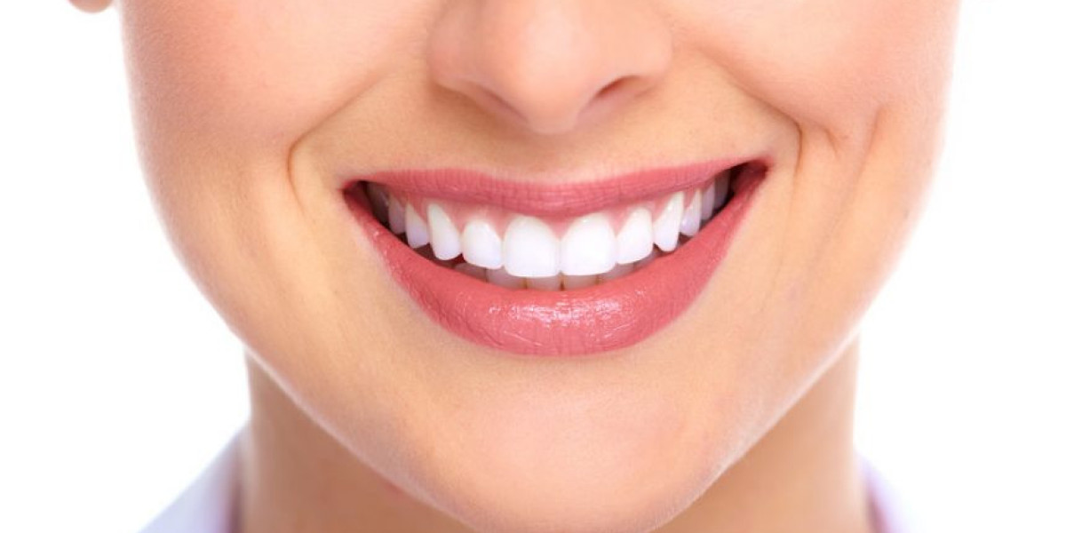 What Makes Dental Implants in Dubai Worth Exploring for a Lasting Smile