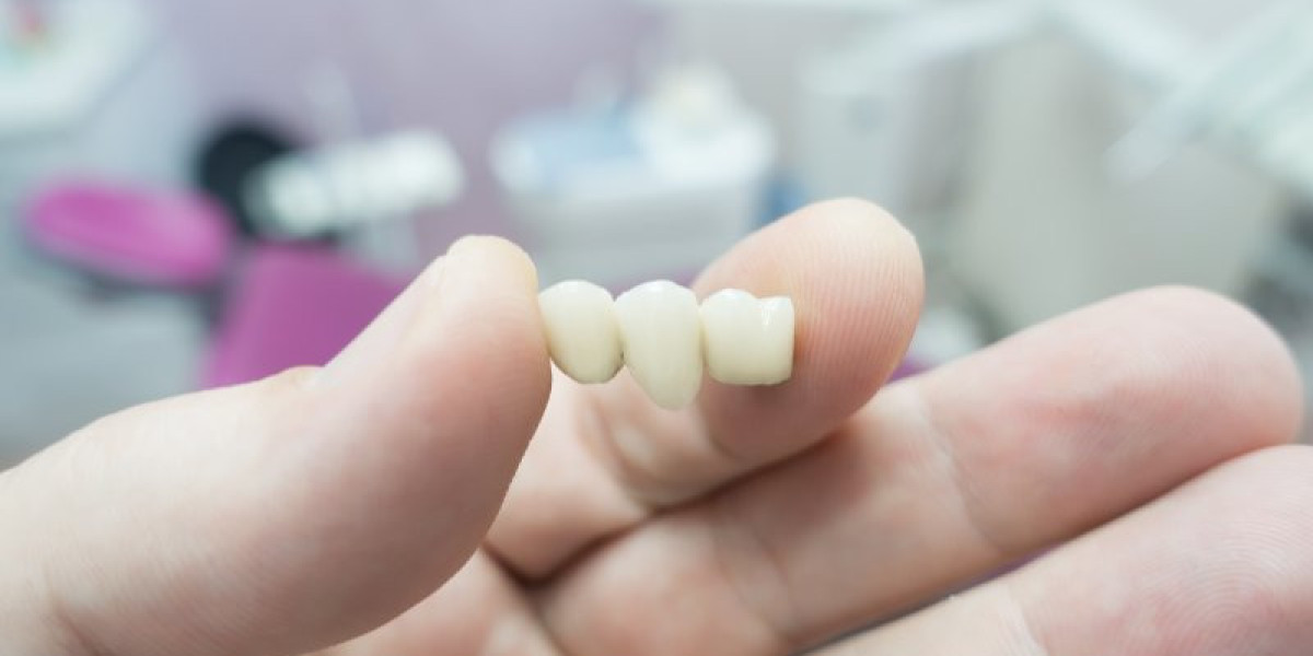 All-Ceramic Dental Crowns and Bridges: Benefits Explained