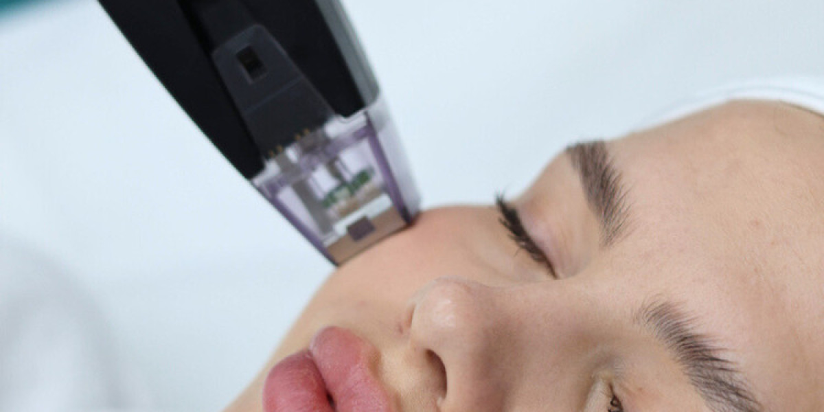 Enhance Skin Vitality Quickly with Morpheus8 in Dubai